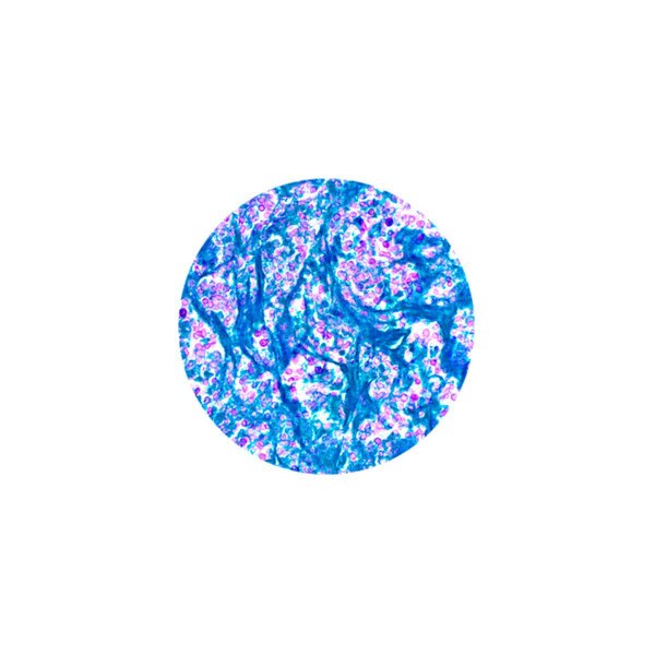 Periodic Acid Schiff (PAS)